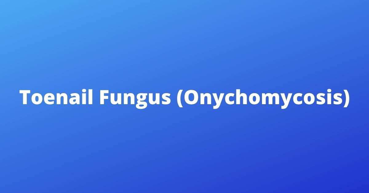 Toenail Fungus (Onychomycosis)