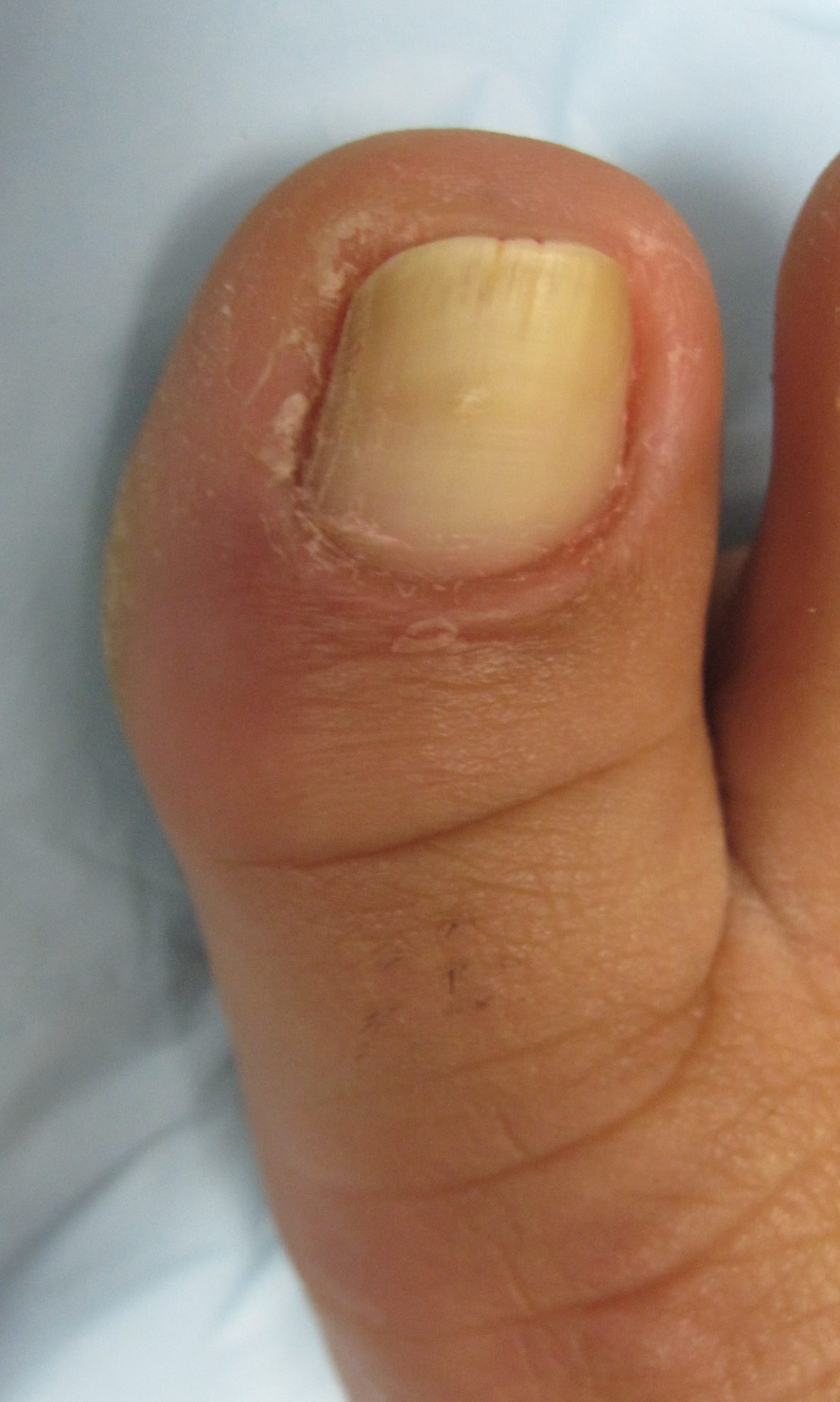 Molly J Timonium Foot and Ankle Center